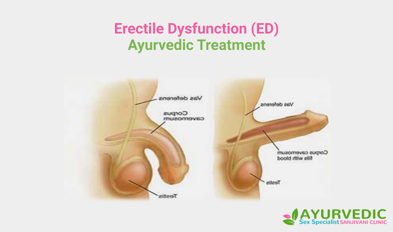 Erectile Dysfunction Ayurvedic Treatment