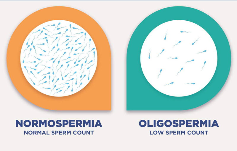 Oligospermia